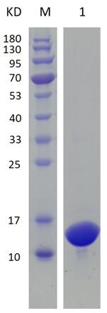 12% SDS-PAGE analysis profiles of purified TB15.3/Rv1636/MT1672 (CBB stained).